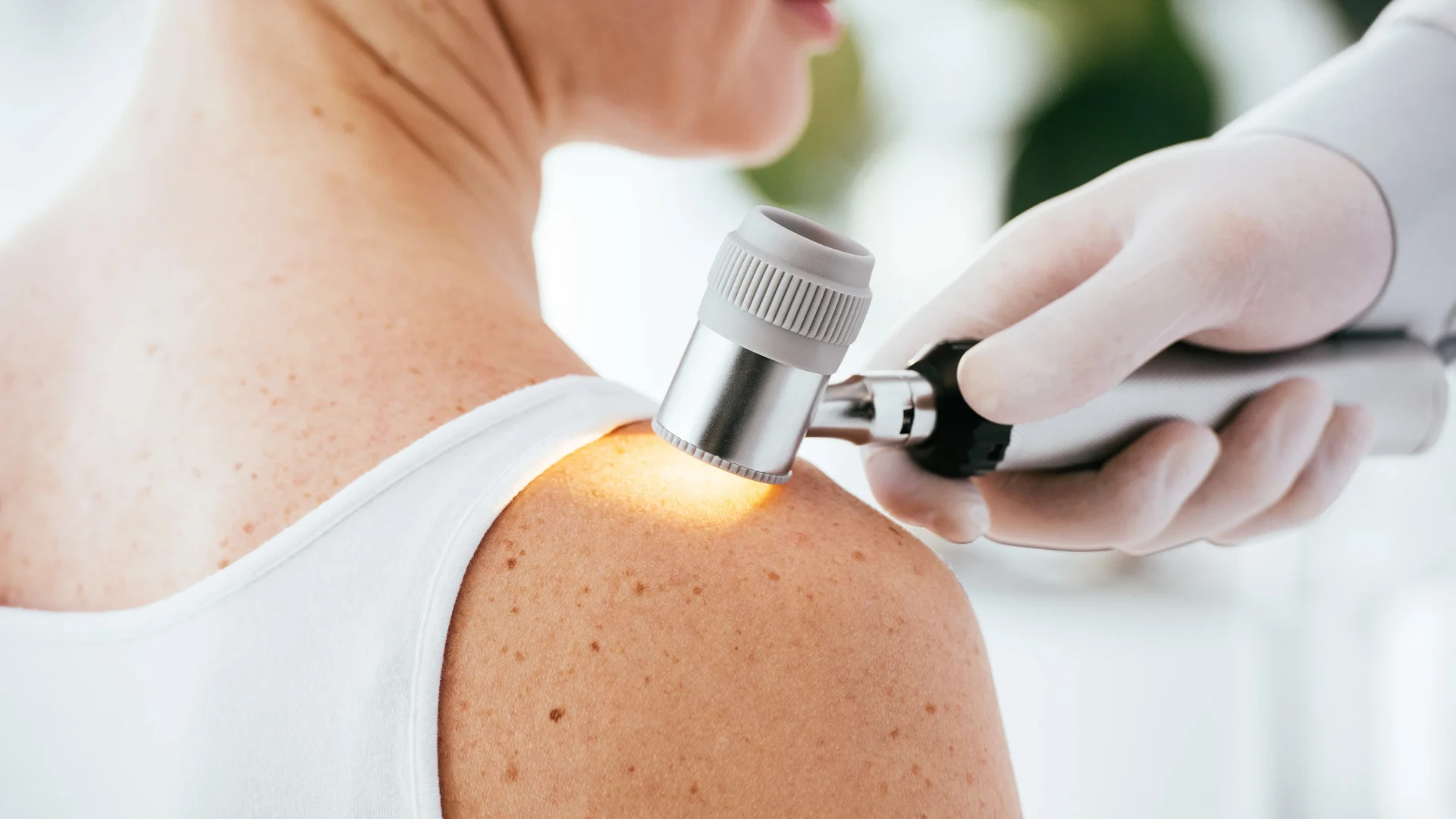 A provider in a white coat uses a dermatoscope to examine a patient’s forearm