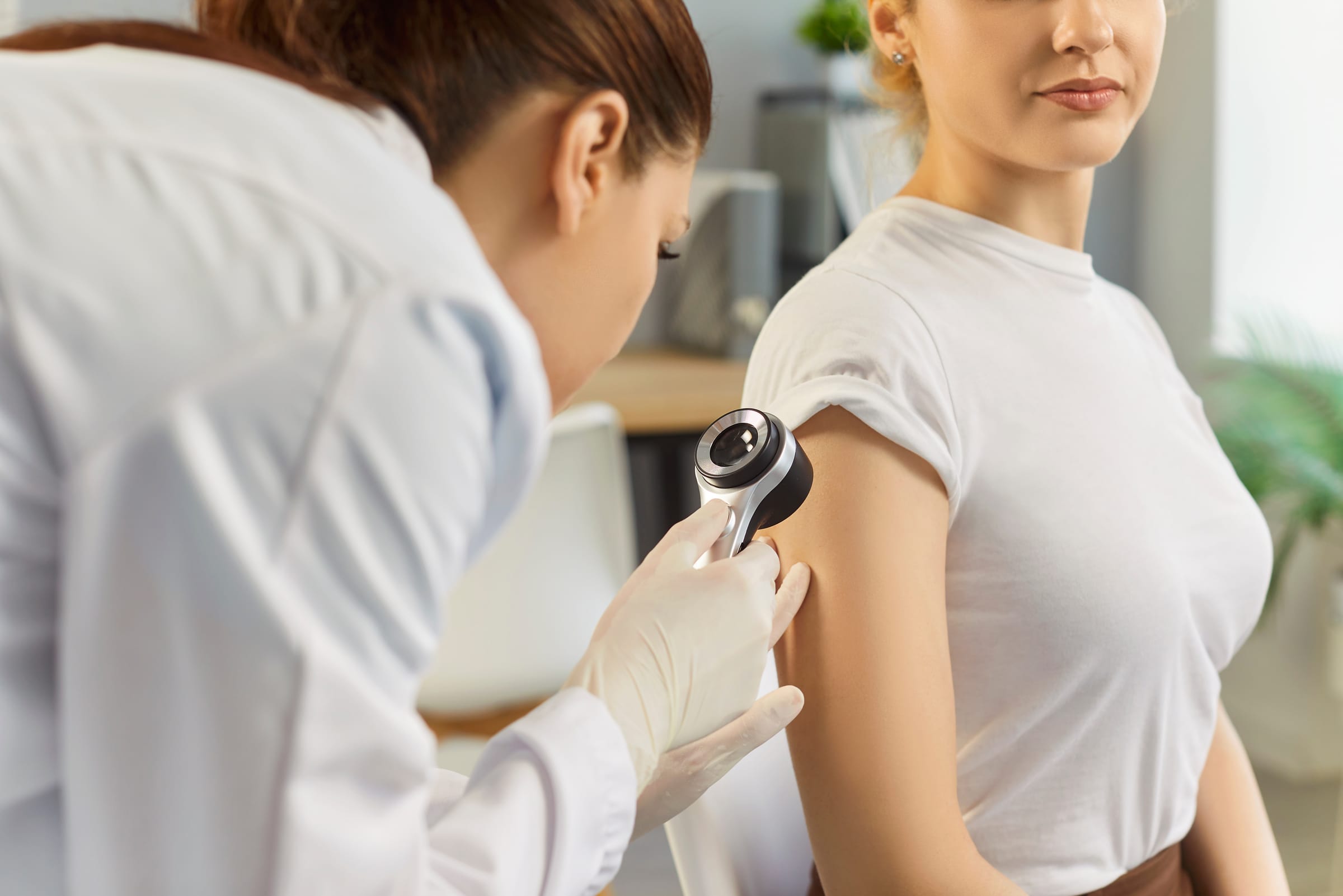 Stock photograph of models: a dermatologist in gloves examines a young woman’s upper arm with a dermatoscope