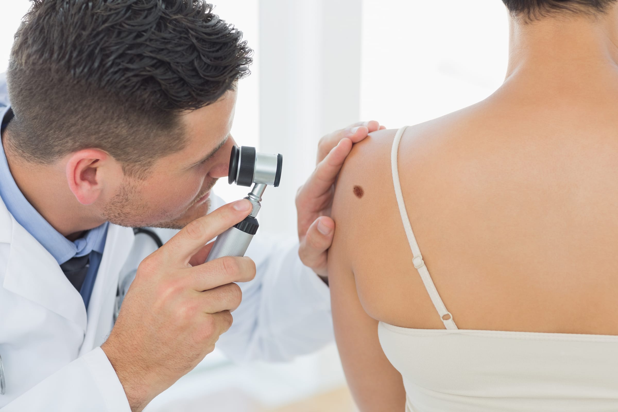 Stock photograph of models: a doctor looks through a dermatoscope at a mole on a woman’s shoulder